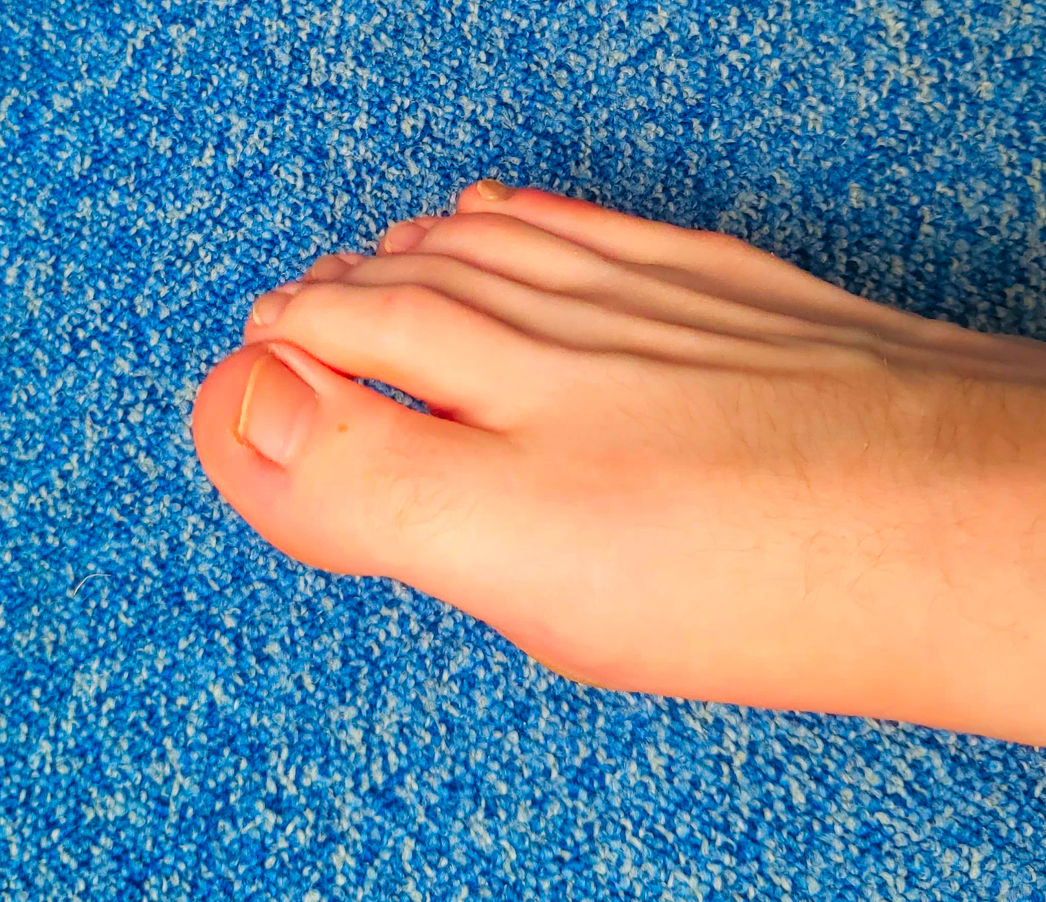 Beau-pied-feet's media