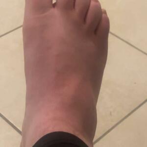 Blacknails's media