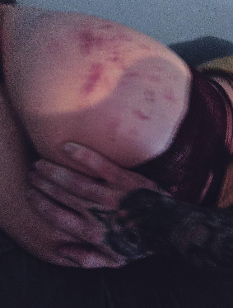 Bloodygirl's media