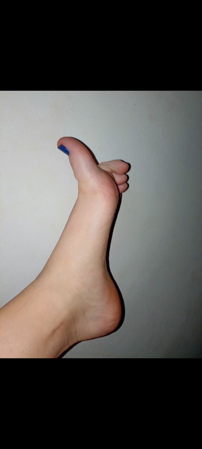 Bothofmyfeet's media