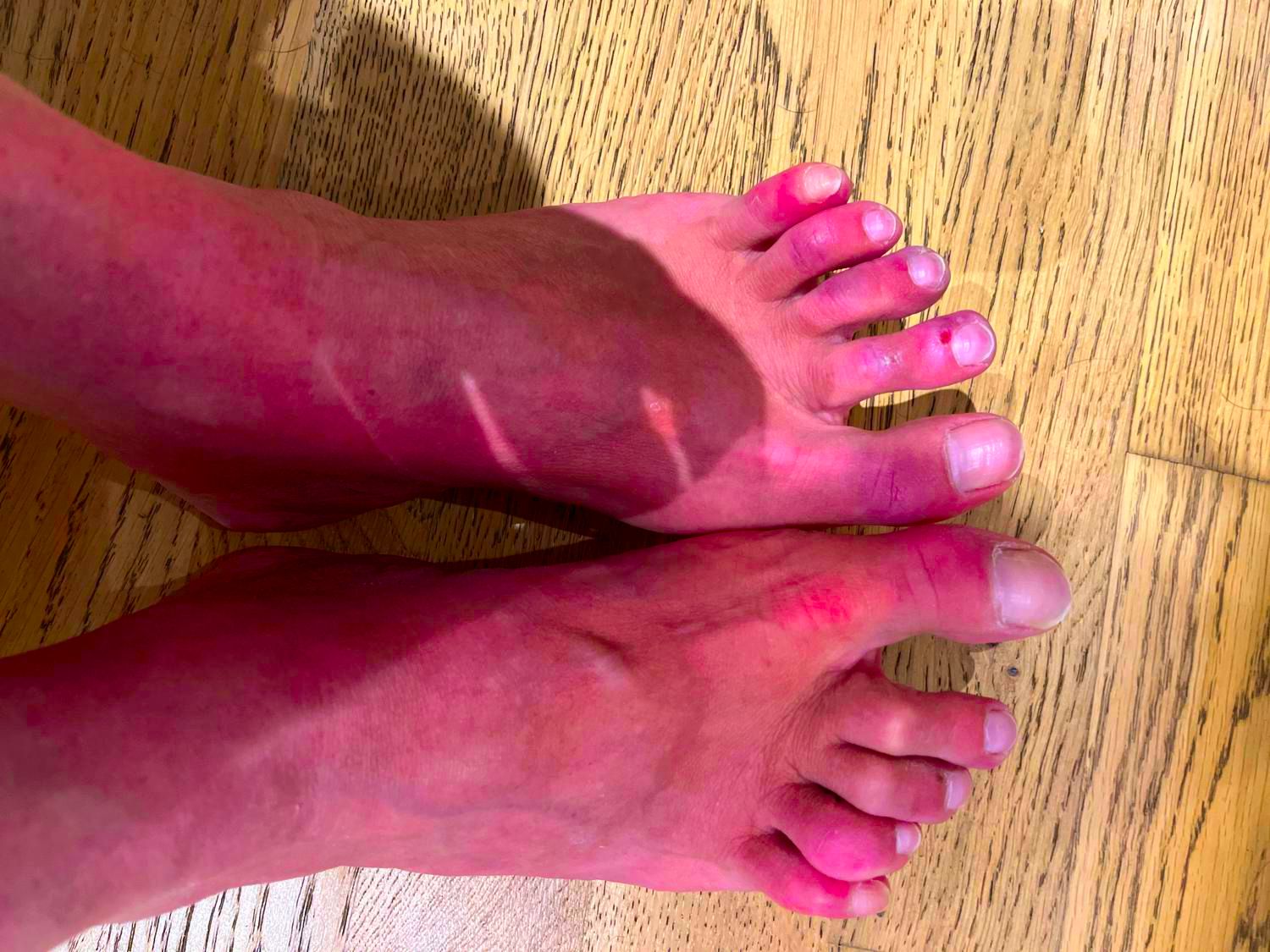 -candyfeet-'s media