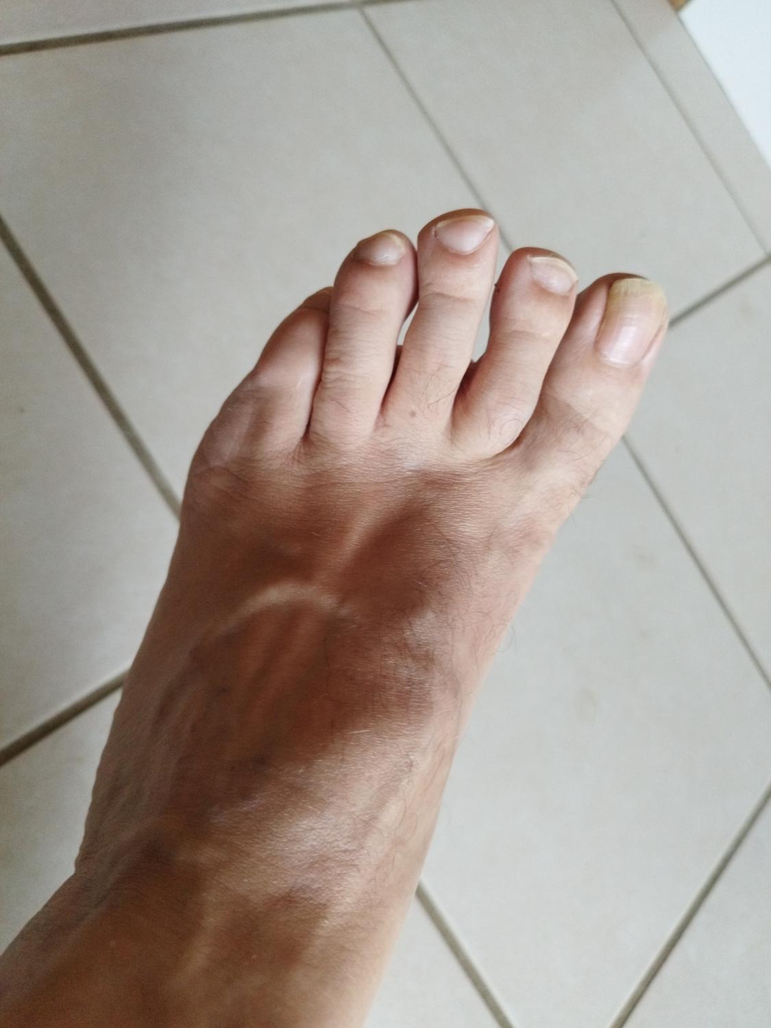 Feetfrenchman's media