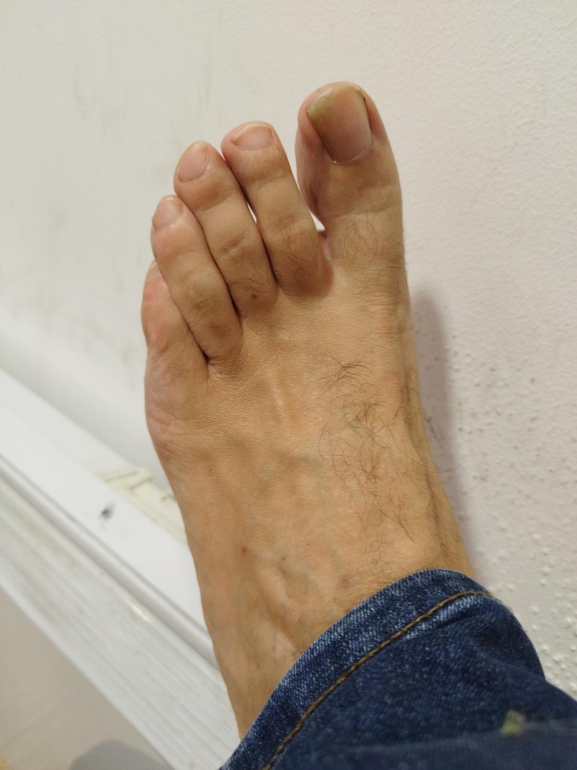 Feetfrenchman's media