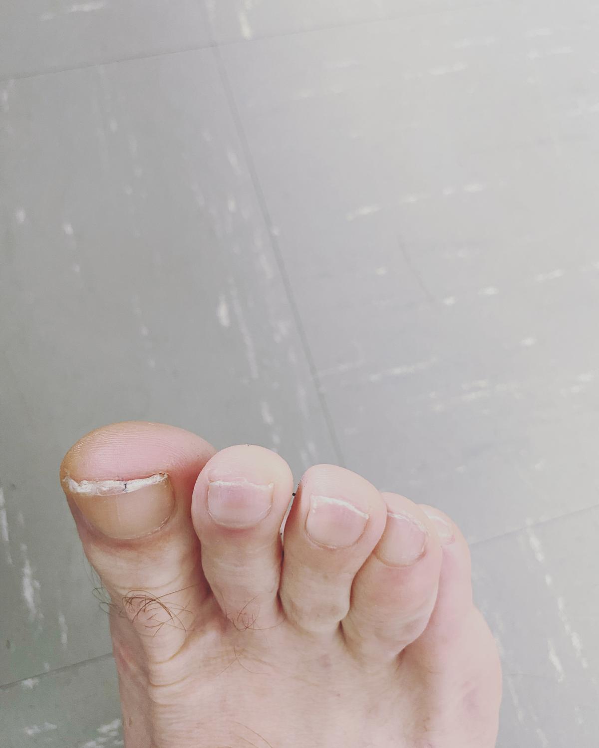 Feetmim's media