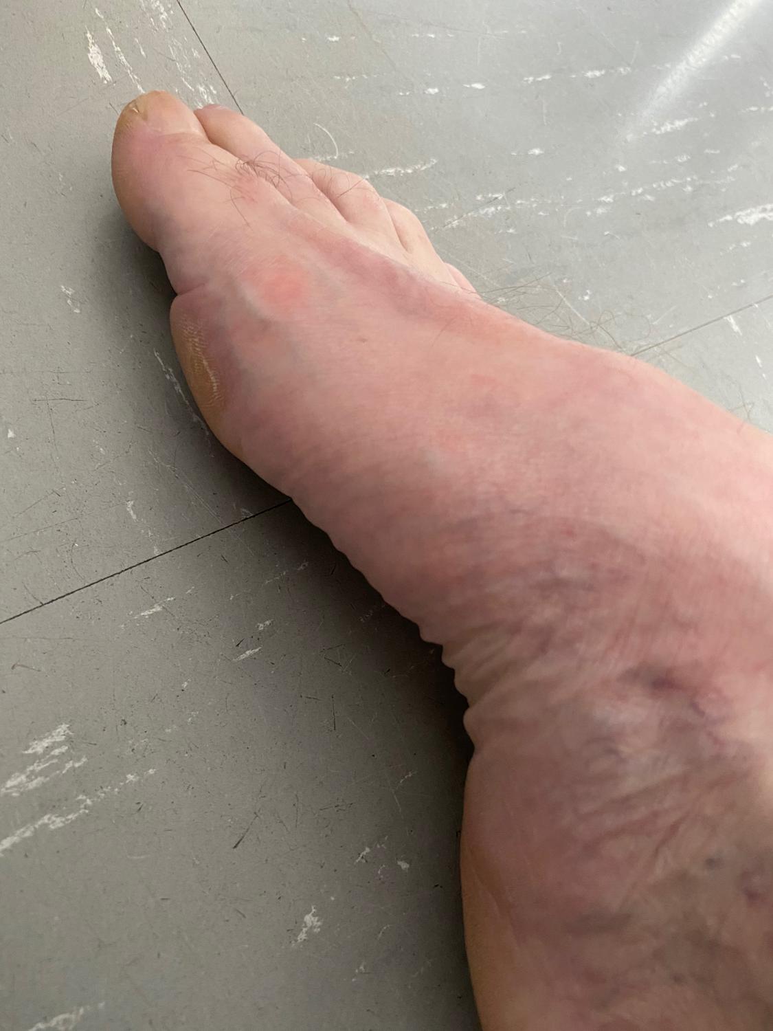 Feetmim's media