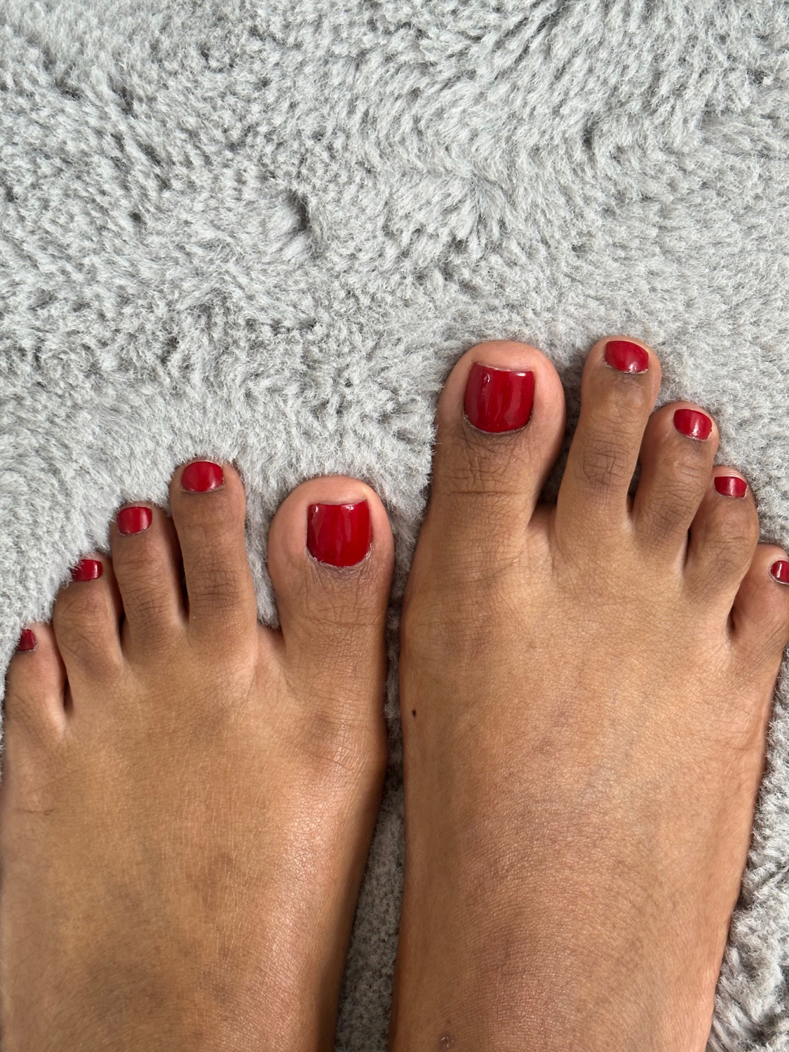 Feetoes's media