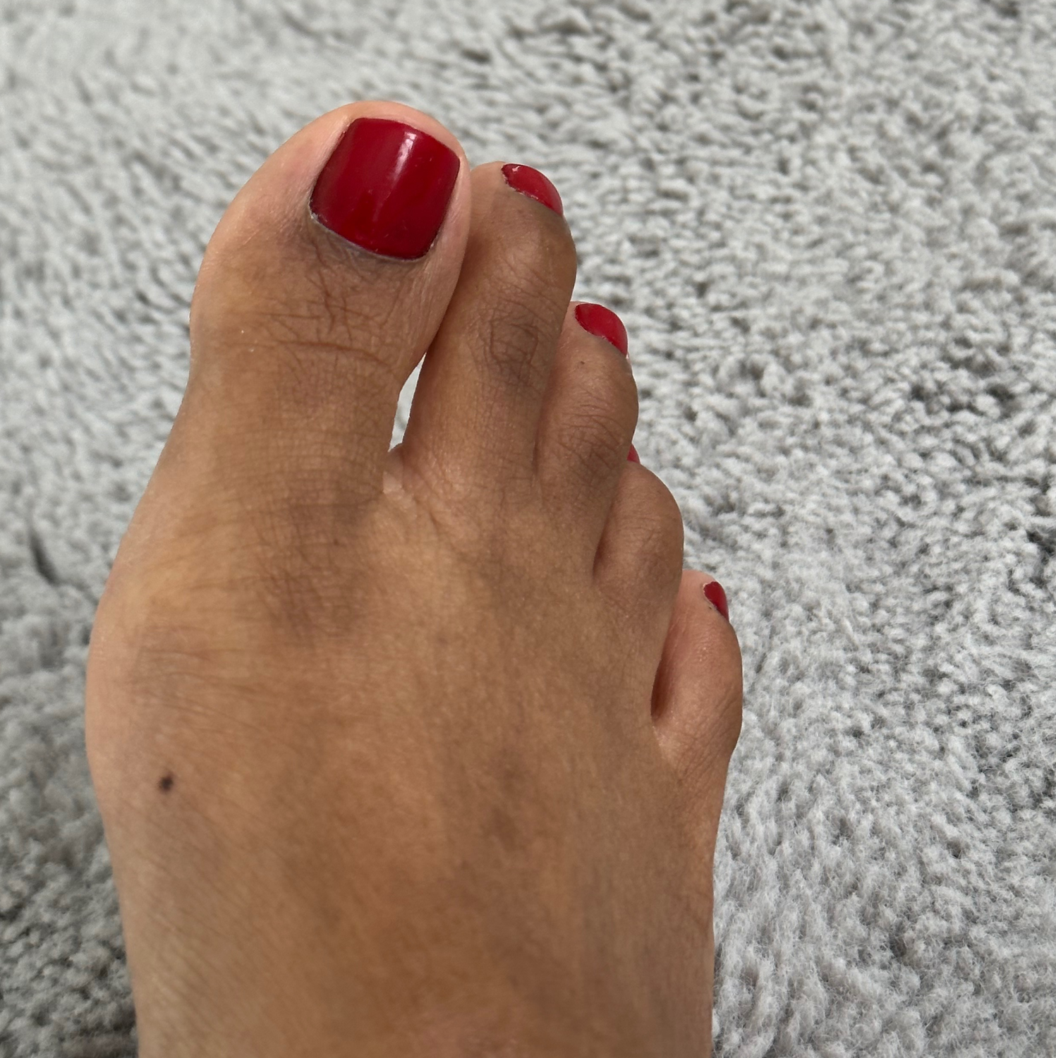 Feetoes's media