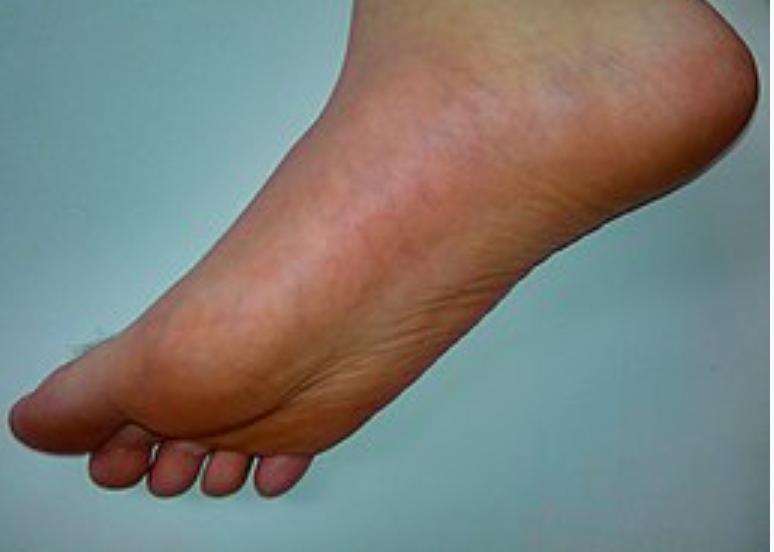 Feetpi3d's media