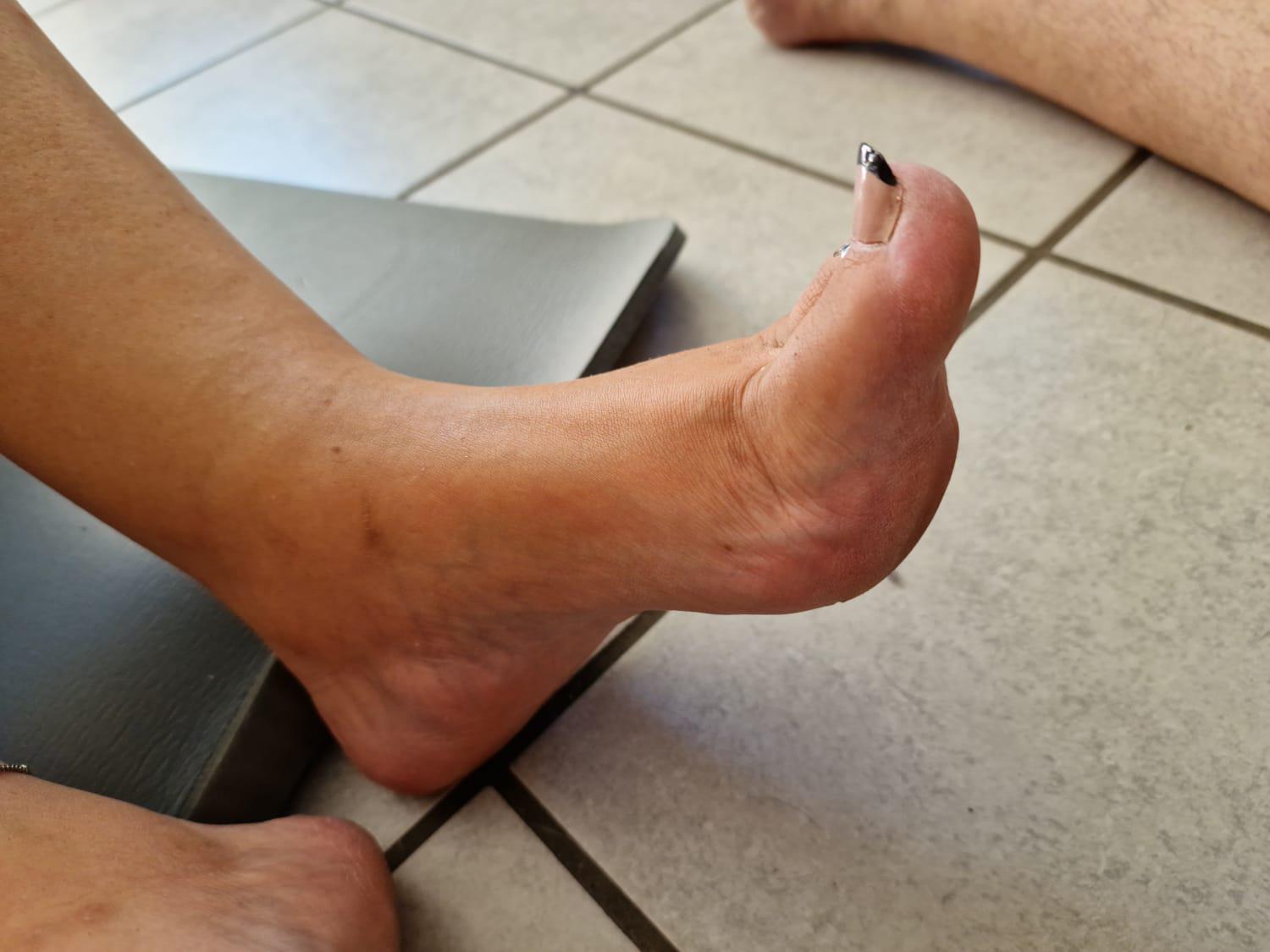 Feetyoyo's media