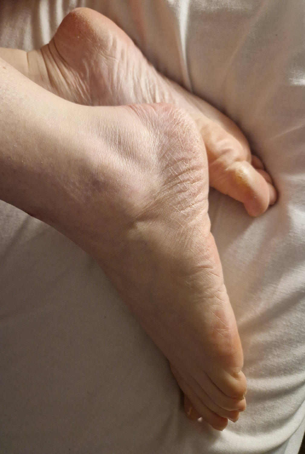 Hand-foot's media