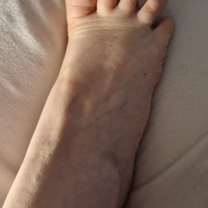 Hand-foot's media