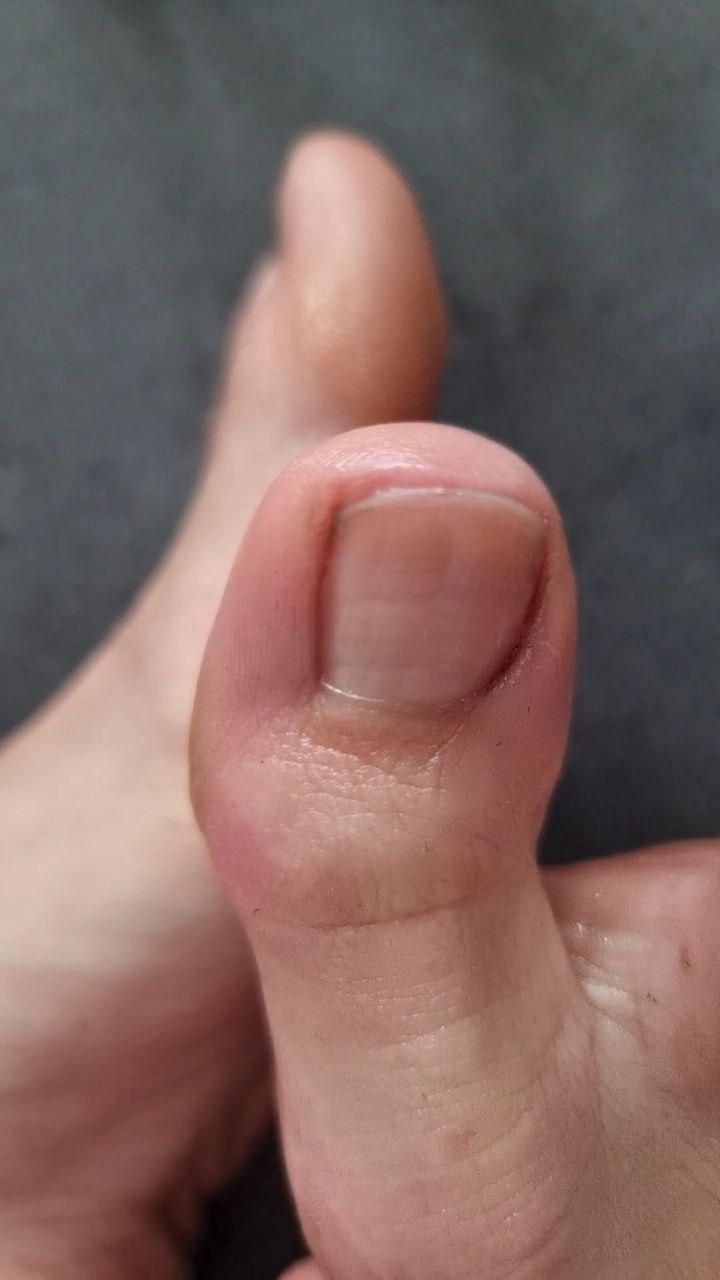 How_i_feet's media