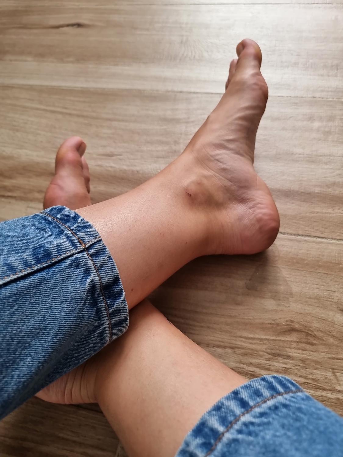How_i_feet's media