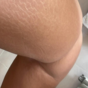Impressionsexuelle's media