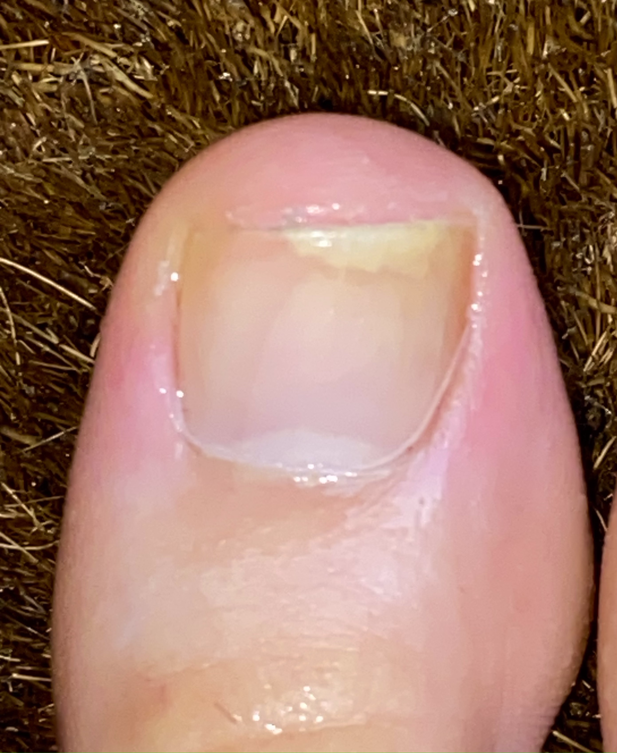 Ladymycosis's media