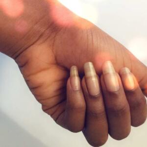 Melanin3's media
