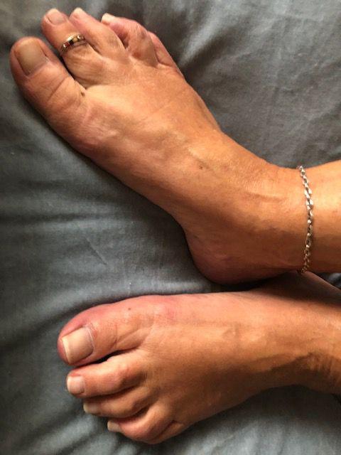 Pieds-dor-mains-dargent's media