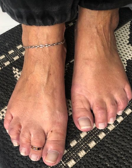 Pieds-dor-mains-dargent's media