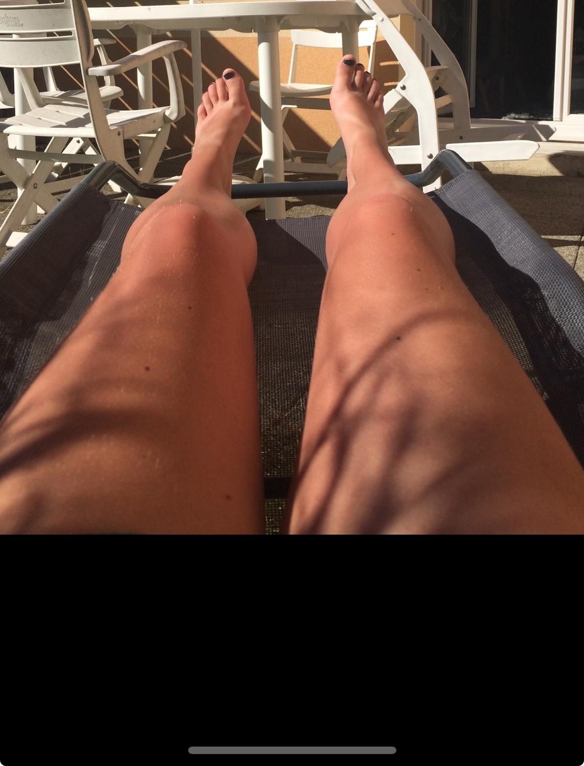 Pieds-mya's media