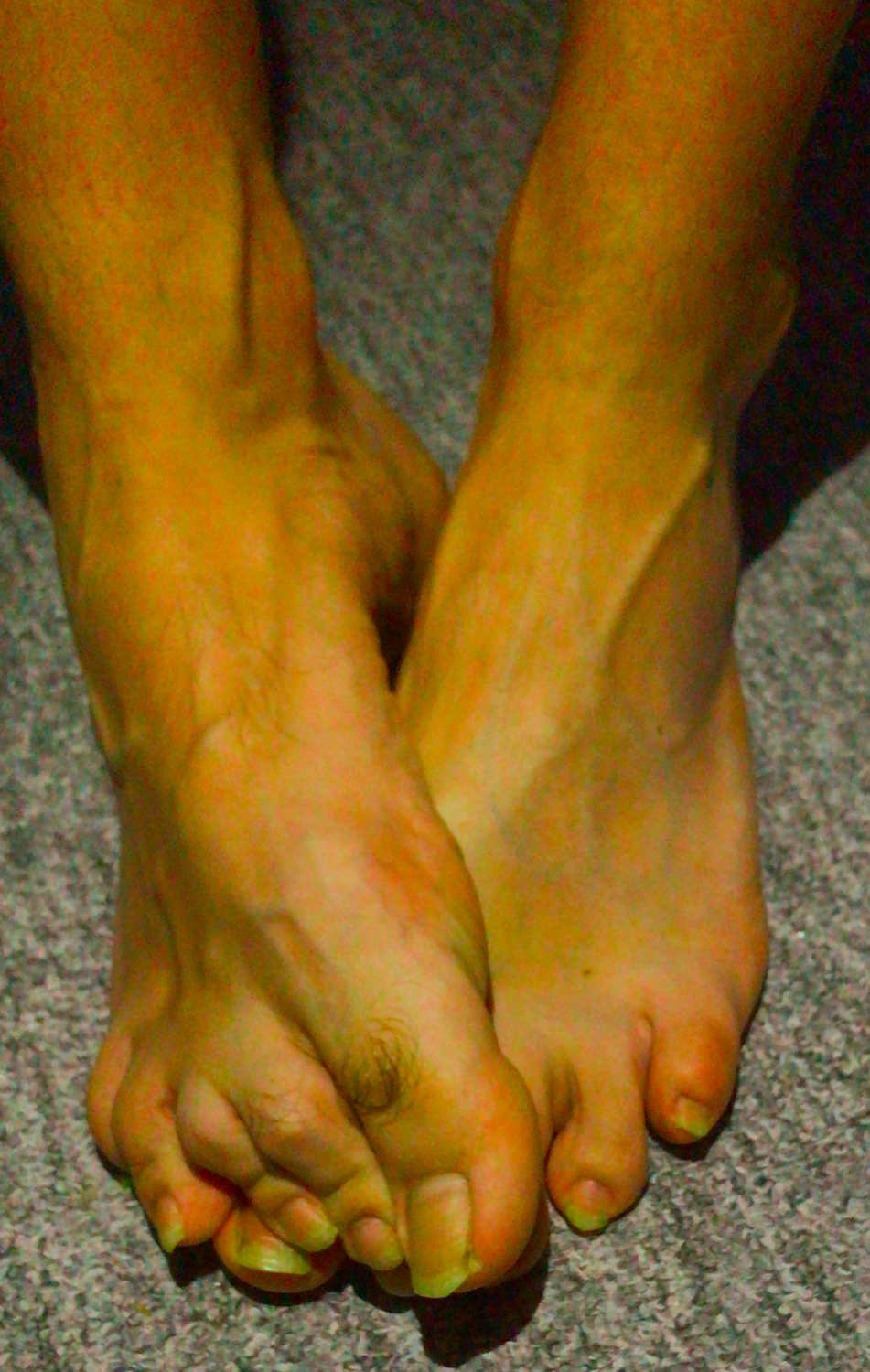 Pieds-tasse's media