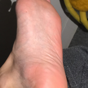 Pieds-tasse's media