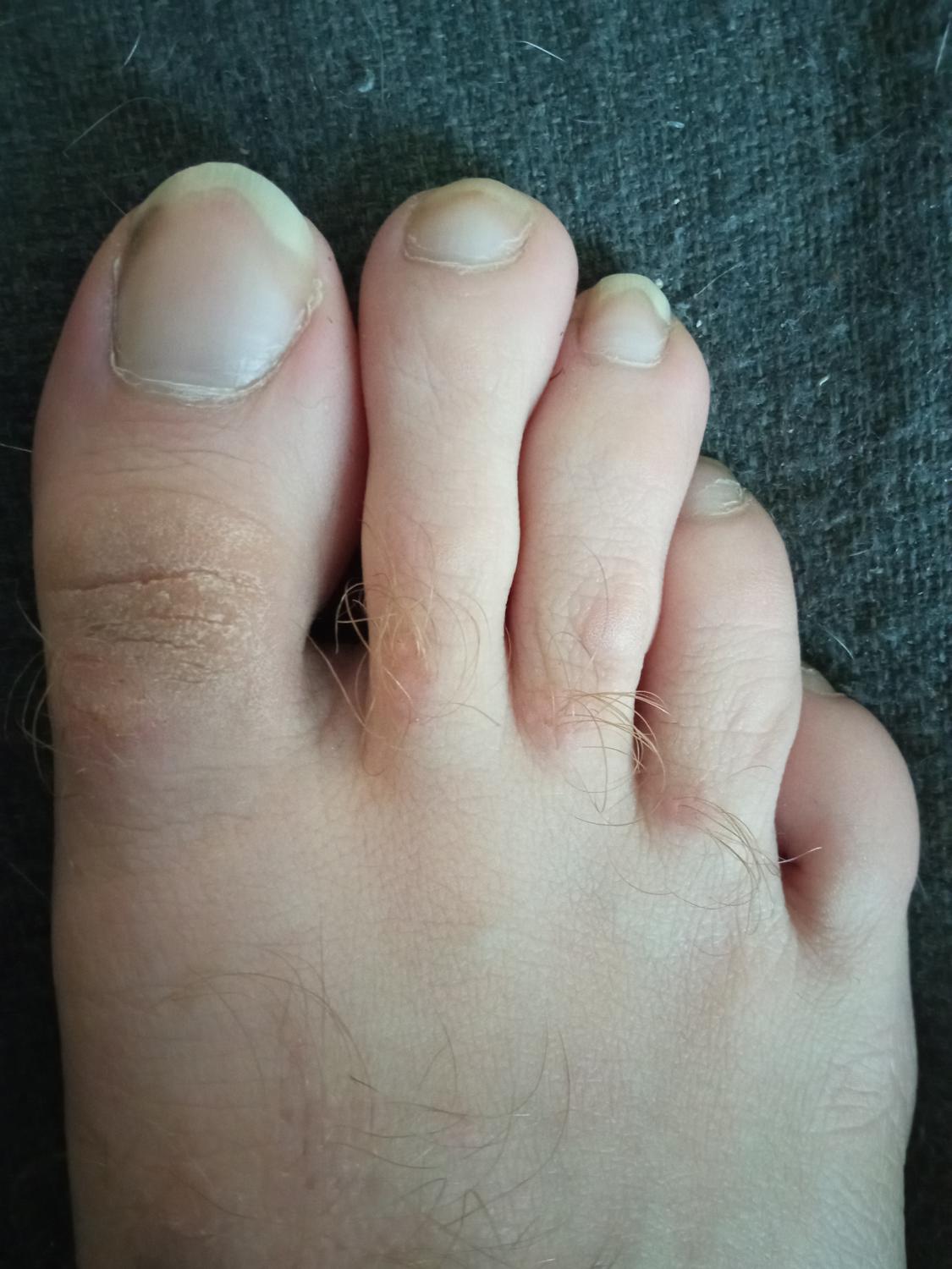 Smallyfoot's media