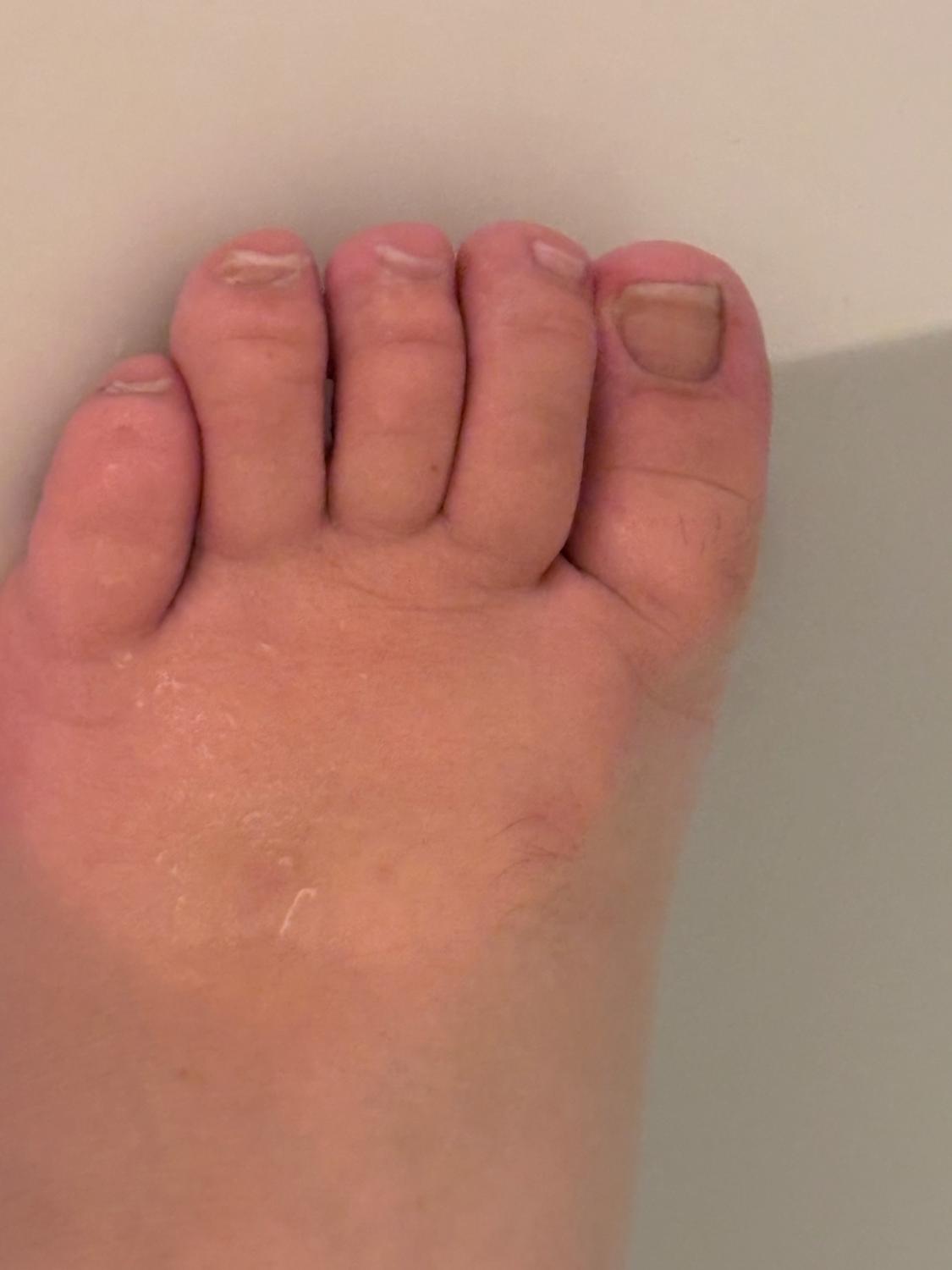 Storyofbarefeet's media